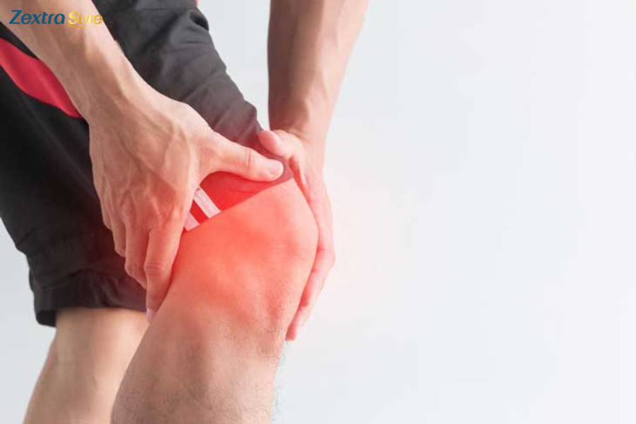 Tricompartmental osteoarthritis causes swelling, discomfort, and warmth